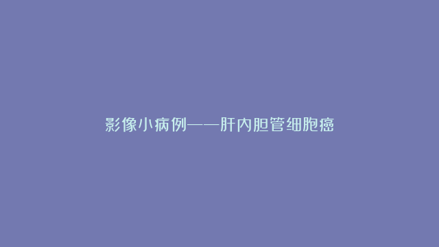 影像小病例——肝内胆管细胞癌